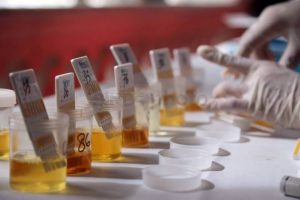 Mendadak, Puluhan Pegawai BNNP NTT Dites Urine