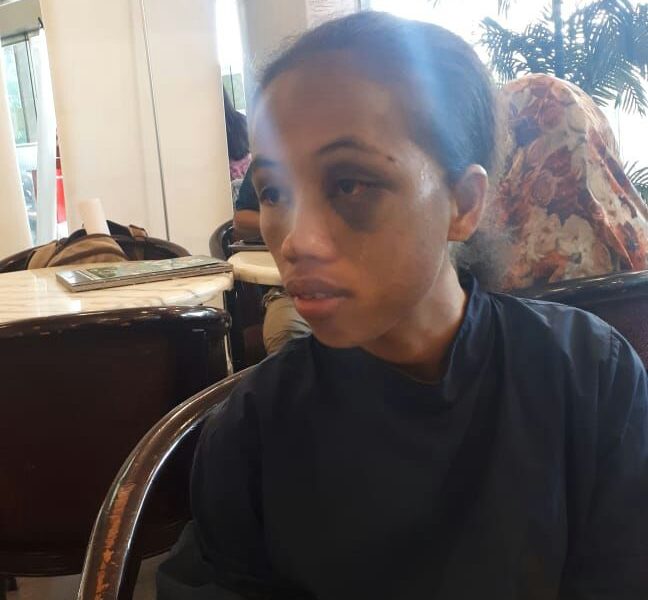 Korban Trafficking di Batam Gadis 16 Tahun Asal TTS