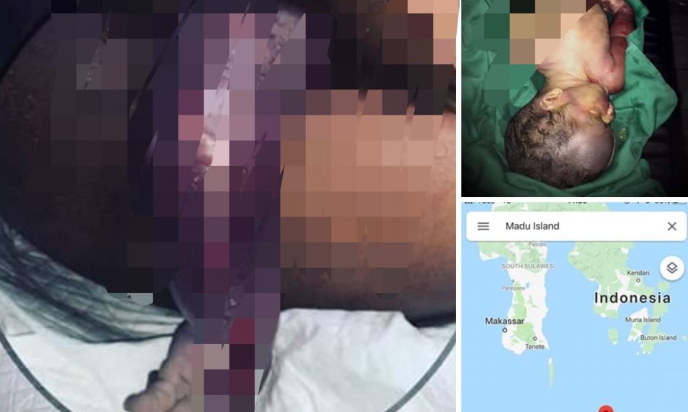 Kisah Pilu Ibu Hamil dari Sulawesi Naik Kapal Kayu Cari RS Sampai di Flores, Bayi Meninggal