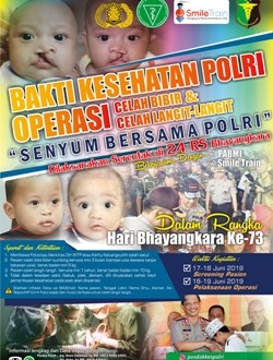 Polda NTT Segera Gelar Operasi Bibir Sumbing Gratis