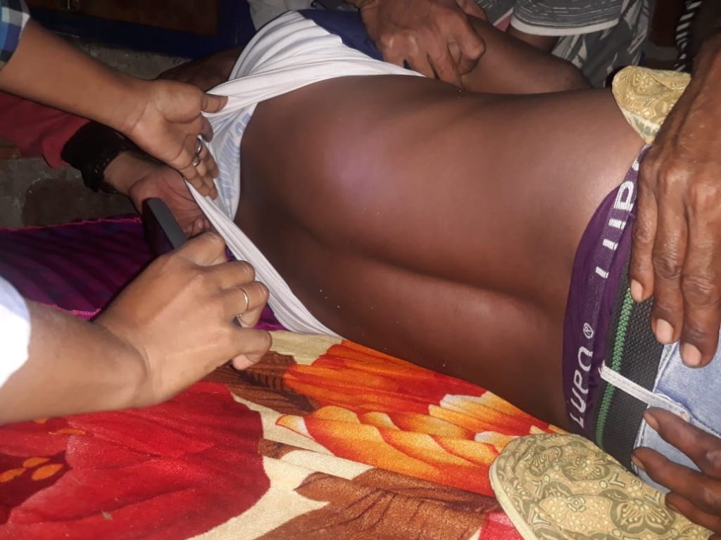 Warga Fatuleu Meninggal Saat sedang Menarik Sapi