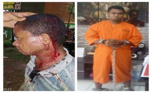 Duel Sesama Pemuda NTT, Satu Terluka, Satu Ditahan