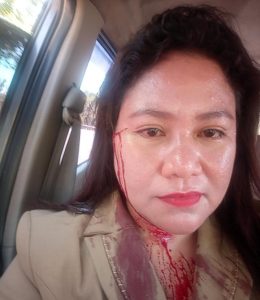 Wali Kota Kupang Perintah Inspektorat Periksa Kasus Penganiayaan ASN Balitbang