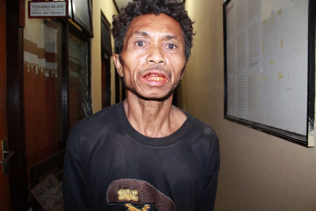 Abraham Mengaku Sulut Api Rokok ke Mulut dan Wajah Korban karena Sering Menangis