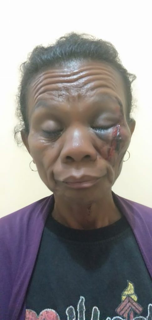 Aniaya Istri, Kakek 63 Tahun Dipolisikan