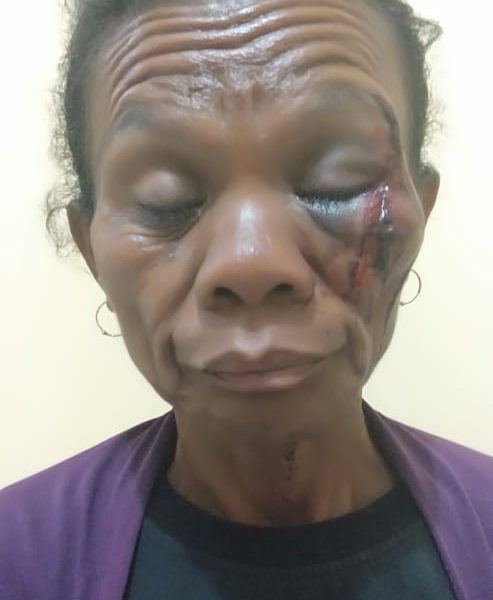 Aniaya Istri, Kakek 63 Tahun Dipolisikan