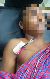 Warga Kupang Terkena Panah di Depan Gereja