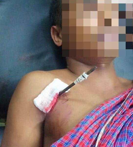 Warga Kupang Terkena Panah di Depan Gereja