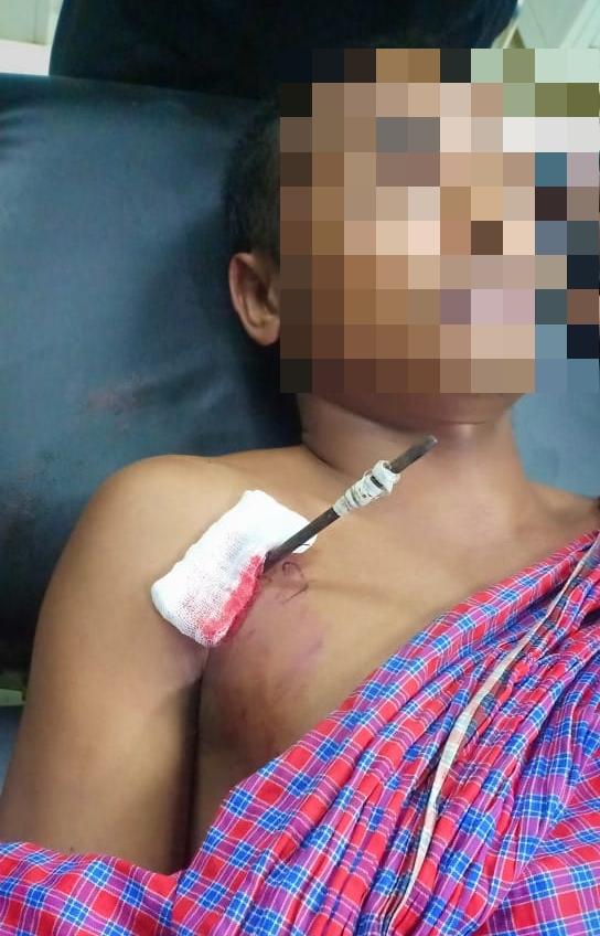 Warga Kupang Terkena Panah di Depan Gereja