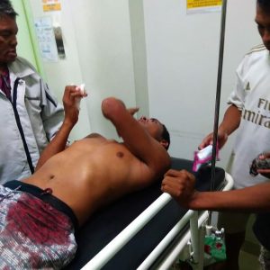 Sadis! Pemuda di Kupang Ini Tikam Pacar Kakaknya dengan Pahat
