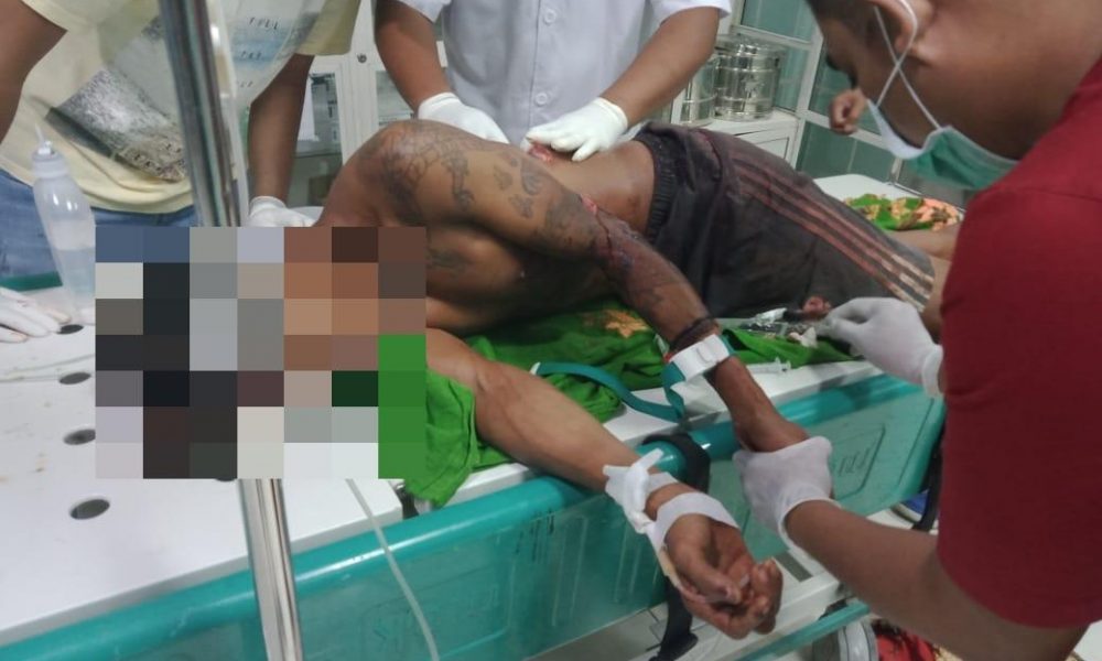 Pegang Pinggul Istri Orang, Pria di Kupang Kritis Diparang