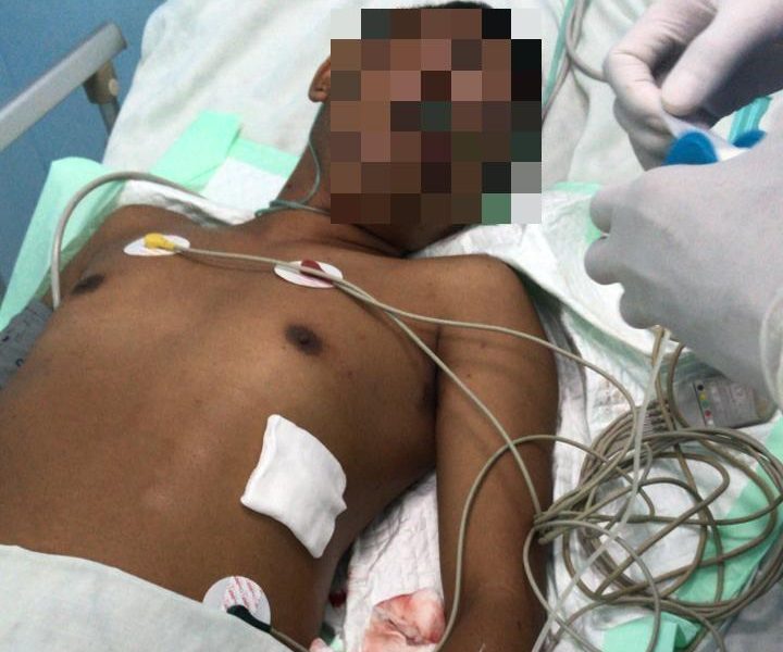 Mabuk dan Aniaya Pedagang Sembako, Preman di Kupang Ditikam hingga Sekarat