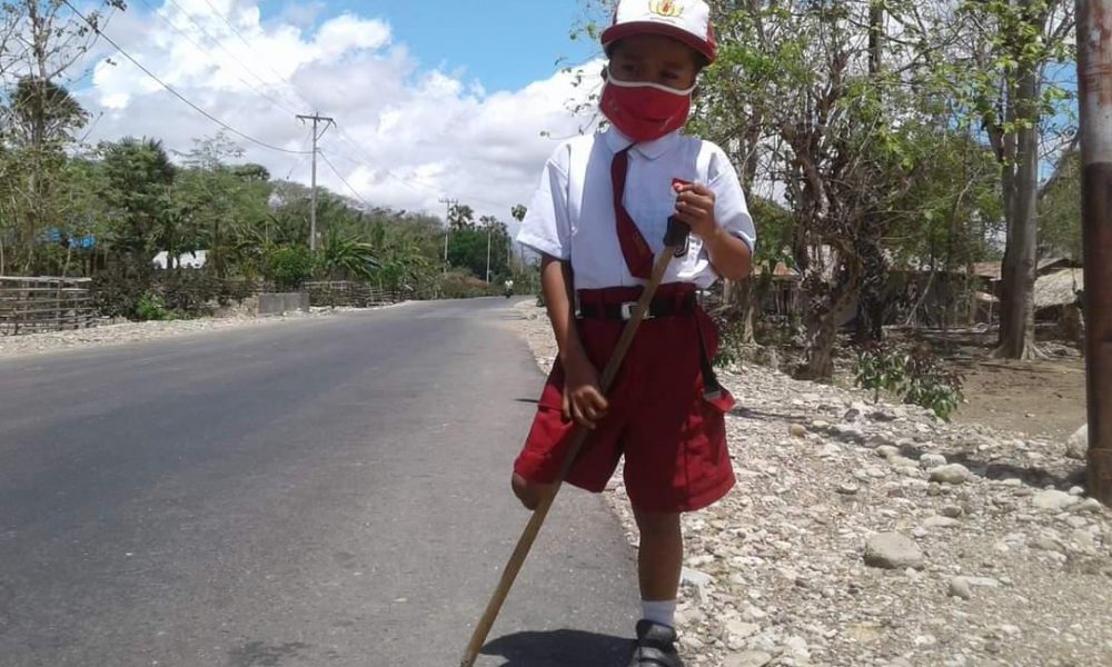 Tetap Semangat Sekolah, Bocah Satu Kaki di Kupang Dambakan Kaki Palsu