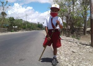 Tetap Semangat Sekolah, Bocah Satu Kaki di Kupang Dambakan Kaki Palsu