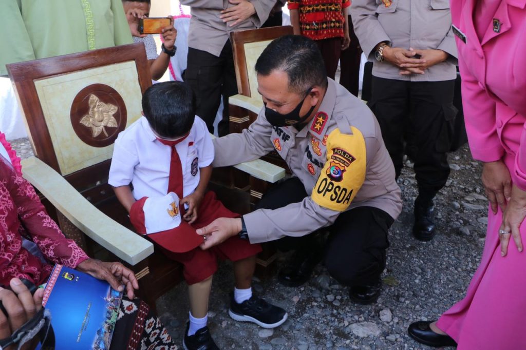 Kapolda NTT Langsung Pakaikan Kaki Palsu untuk Yesi Ndun, Bocah Difabel di Kupang
