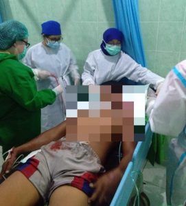 Seorang Nelayan di Kupang Nyaris Tewas Digigit Buaya