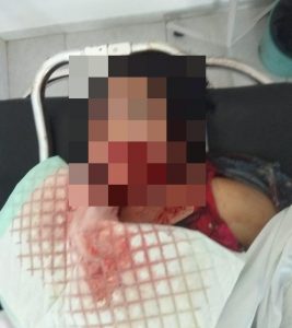 Seorang Karyawati SPBU di Kupang Ditemukan Tak Bernyawa, Diduga Dibunuh
