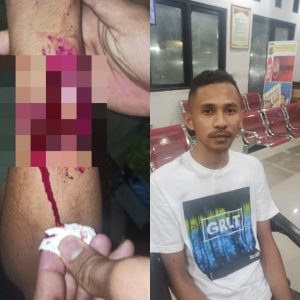 Seorang Pemuda di Kupang Terluka Parah, Dibacok Teman Sendiri