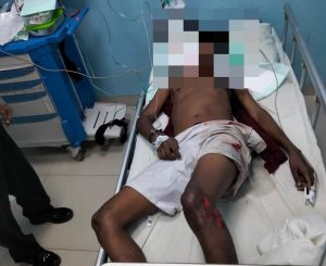 Kecelakaan Tunggal di Kupang, Pemuda Tanpa Identitas Ini Sekarat di Rumah Sakit