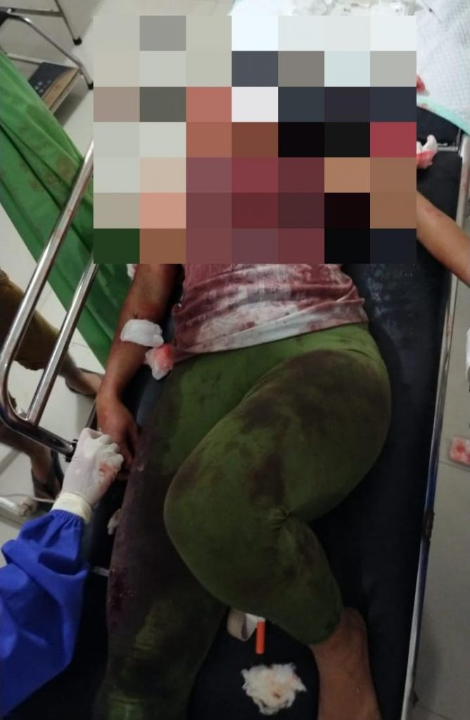 Sering Dihina, Pria di Rote Ndao Bacok Istri Kakaknya hingga Tewas