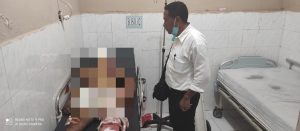 Pria Pembakar Rumah di Sumba yang Tewaskan 4 Orang Ikut Meninggal