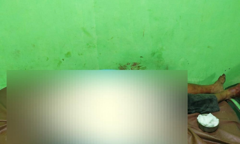 SADIS! Gegara Mabuk Miras, Pria di NTT Tewas Dibacok Temannya hingga Dada Terbelah