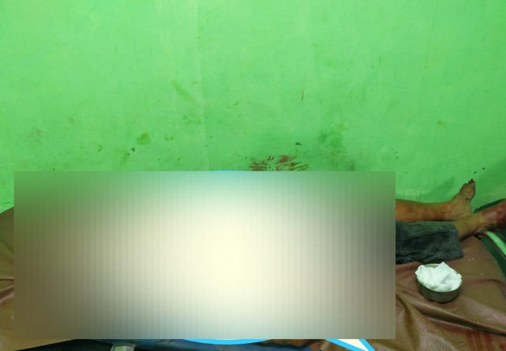 SADIS! Gegara Mabuk Miras, Pria di NTT Tewas Dibacok Temannya hingga Dada Terbelah