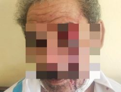 Oktovianus Hetmina Babak Belur Dianiaya Seorang Sopir Mobil Plat Merah di Kupang