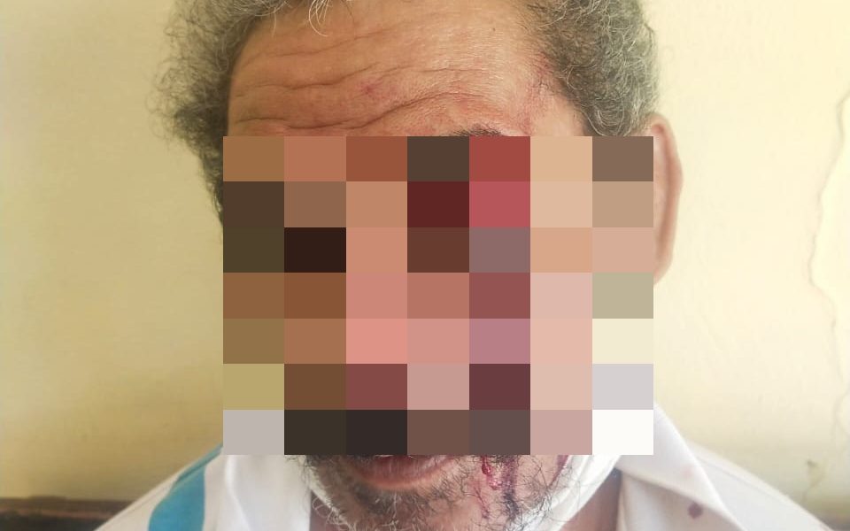 Oktovianus Hetmina Babak Belur Dianiaya Seorang Sopir Mobil Plat Merah di Kupang