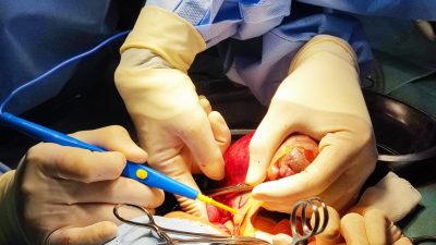 Bayi Laki-laki di Kupang yang Punya Janin Dioperasi selama 4 Jam